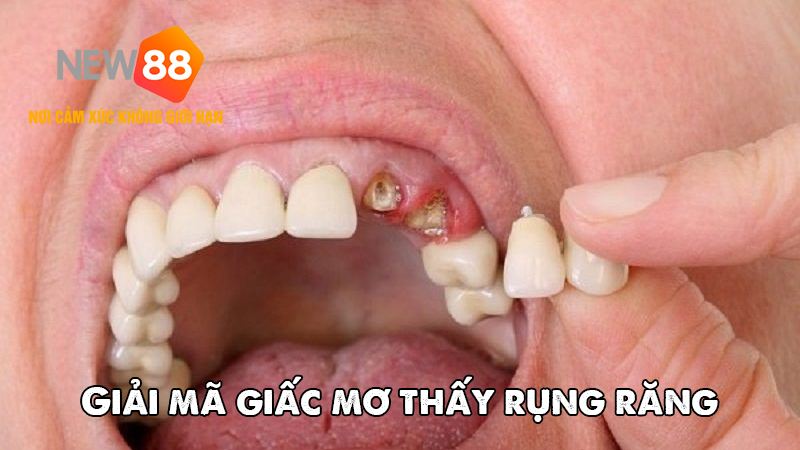 Góc nhìn khoa học qua giấc mơ thấy rụng răng
